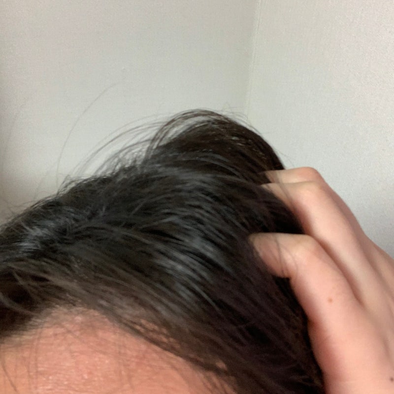 나는 머리를 긁지 않고 그것을 극복했다.