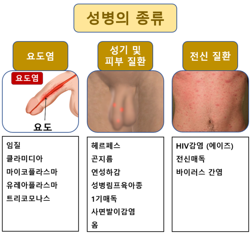 남자 비임균성 요도염의 증상과 검사 : 네이버 블로그 남자 비임균성 요도염의 증상과 검사 : 네이버 블로그