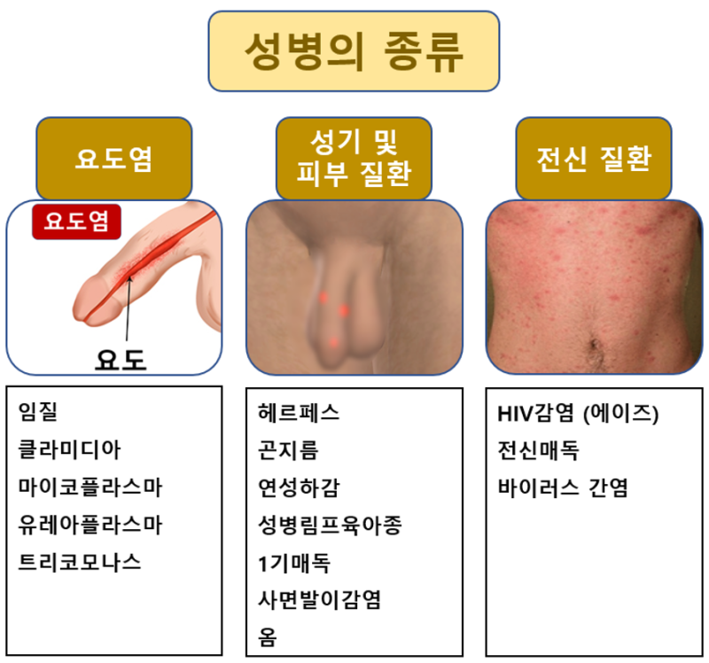 남자 비임균성 요도염의 증상과 검사 : 네이버 블로그