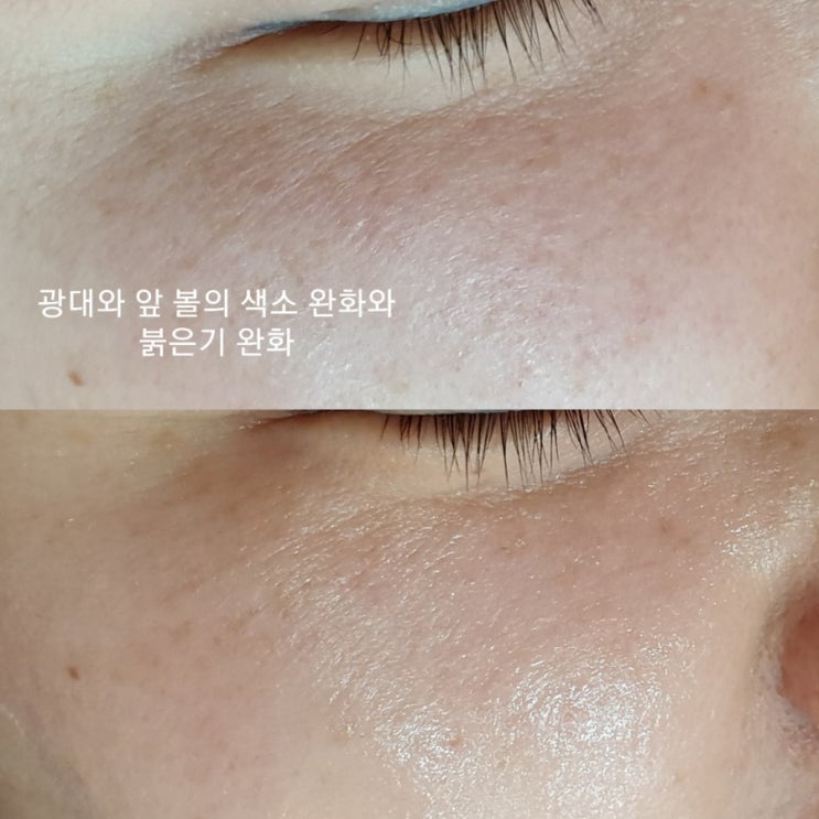 물광 프로그램 후기 <올레 스킨룸_ 천안피부관리실>