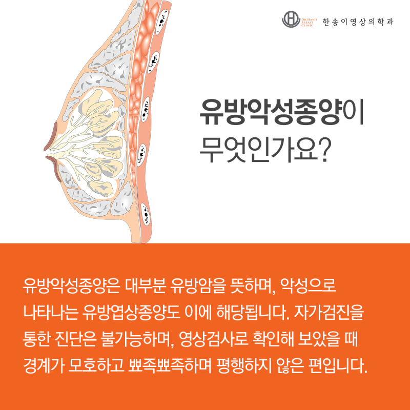 유방의 엽상종양... 공격적인가요 악성인가요? 4