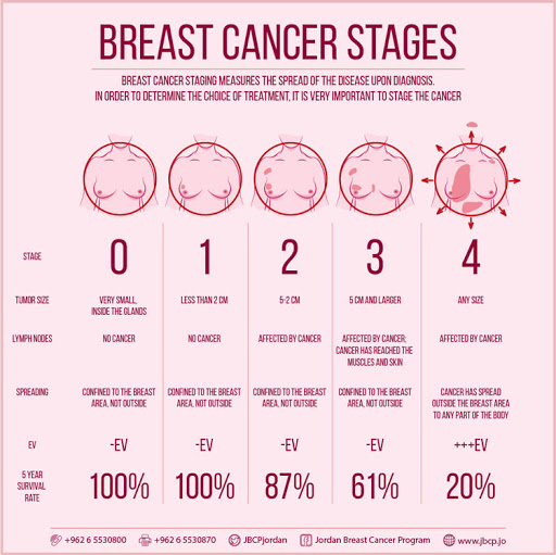 유방암의 치료전략