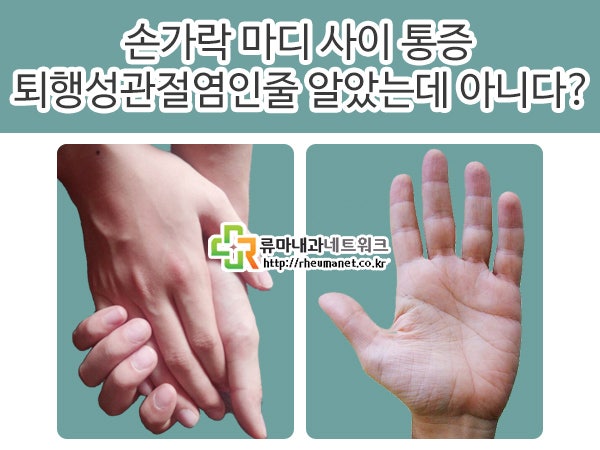 손가락 마디 사이 통증이 퇴행성관절염인줄 알았는데 아니라고 네이버 블로그