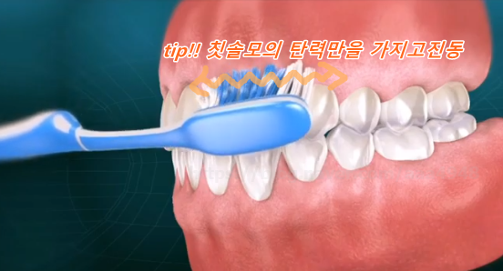  치은염과치주염에는 바스법칫솔질