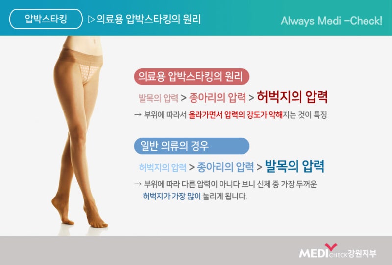다리 압박 스타킹의 종류와 부작용 알아보기 2