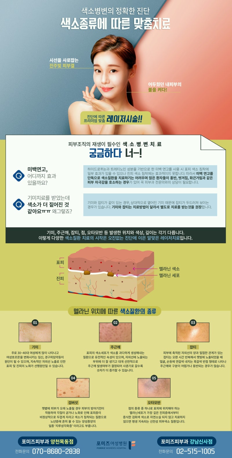 강남피부과추천 난치성 색소 질환의 종류와 치료 방법