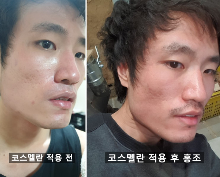  효과가 뛰어난 코스멜란 자주 하는 질문 모음집 2편 (홍조, 사우나, 주의사항)