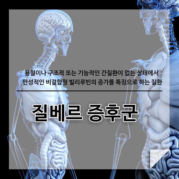 질베르 증후군 원인과 증상 치료는?
