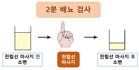  [울산 비뇨기과] 전립선염, 정액검사가 필요할까?