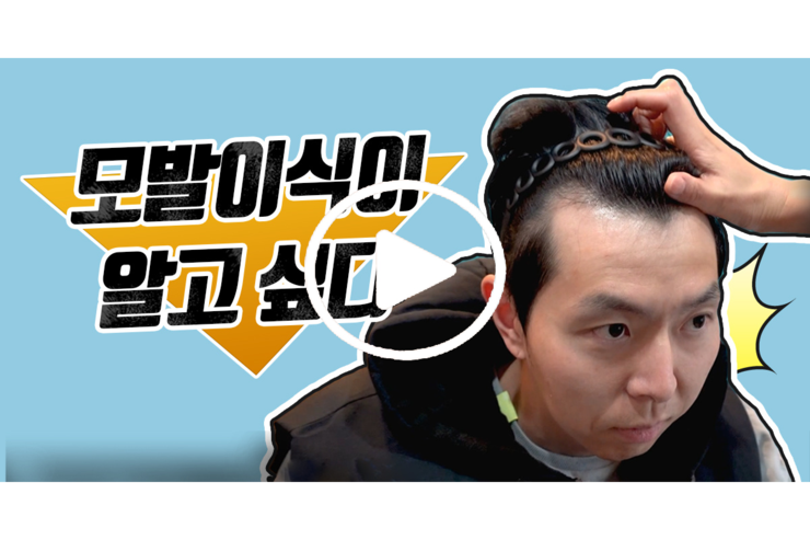  비절개 모발이식 후기 2개월차 솔직리뷰/헤어라인 후기
