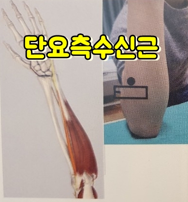  단요측수근신근 위치, 통증 (Extensor carpi radialis brevis ECRB)