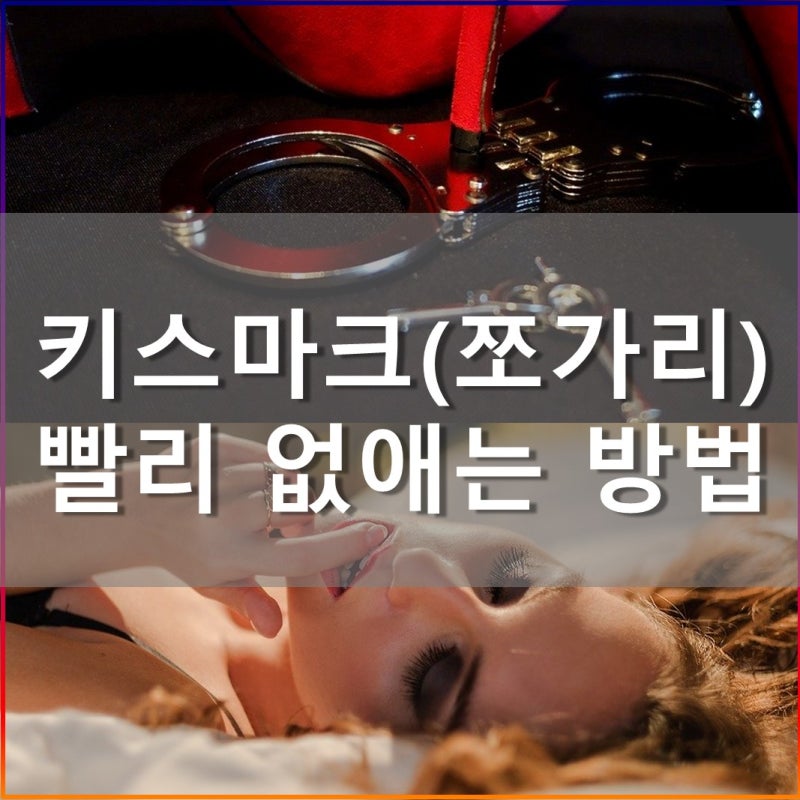 키스 마크 빨리 없애는법 하루면 돼 : 네이버 블로그