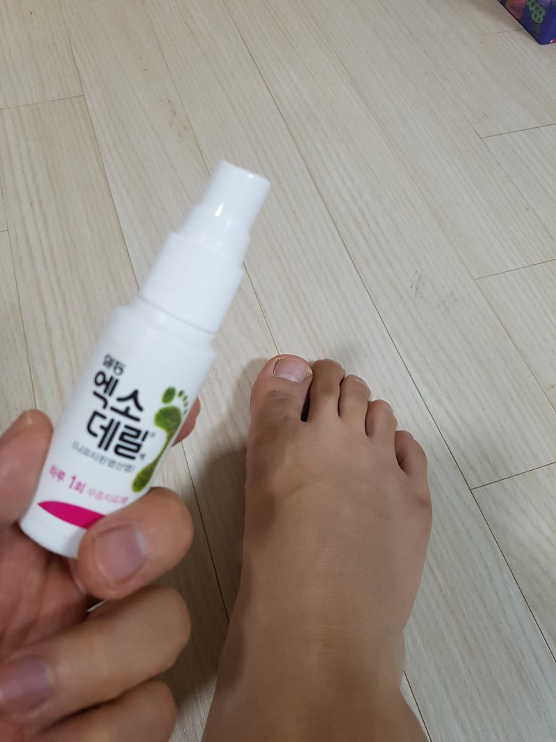일동EXO델릴크림성분및효능나프티핀염산염나프타파인염수충치료무좀약Naftifinehydrochloride 13