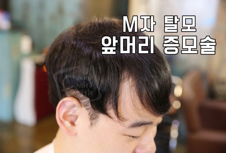  남자 앞머리 갈라짐 정품 테이프 붙임머리저렴 하게 할 수 있는 곳