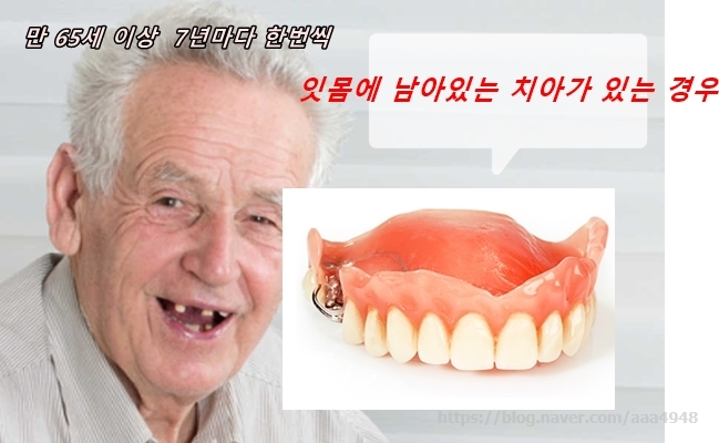  보험틀니적용기준과비용