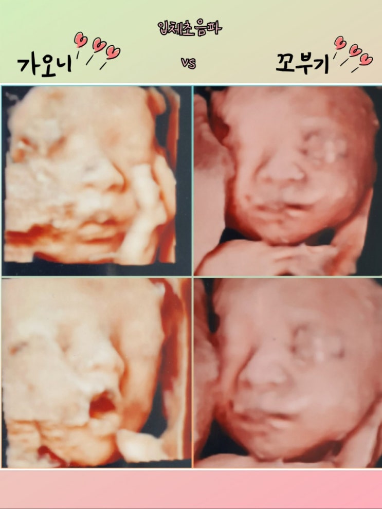  임신8개월 입체초음파 찍구왔어요 :) 엠제이산부인과