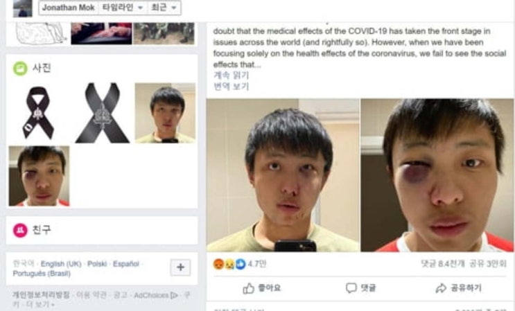 전세계에서 일어나고있는 코로나동양인 인종차별 폭행 전세계에서 일어나고있는 코로나동양인 인종차별 폭행