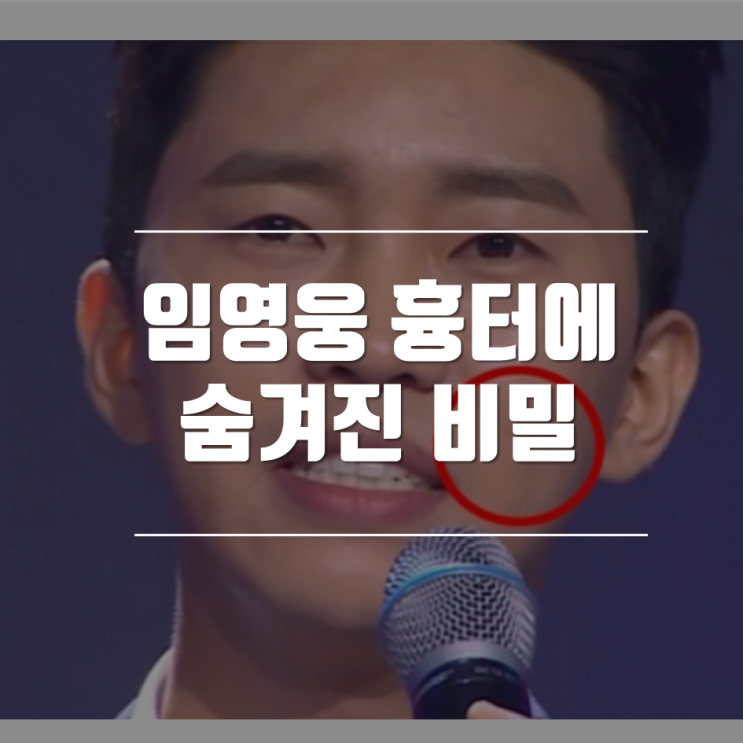 임영웅 흉터에 숨겨진 비밀 무엇?