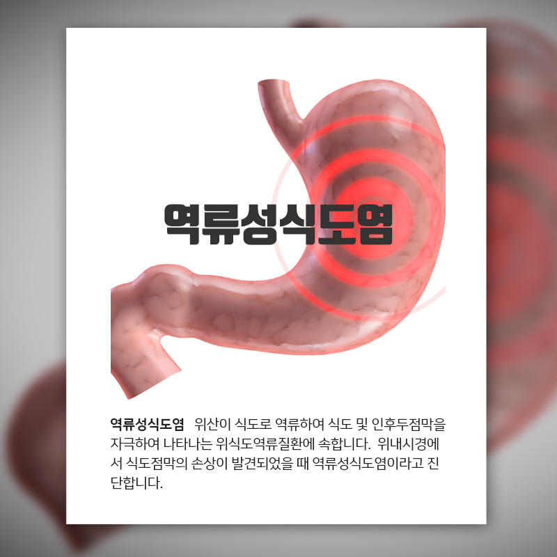 담적 위가 무력한 상태라는 진단을