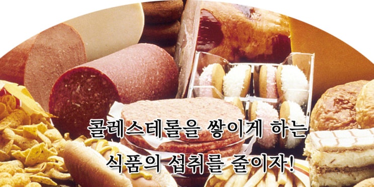  콜레스테롤을 만드는 식품의 섭취를 줄이자.