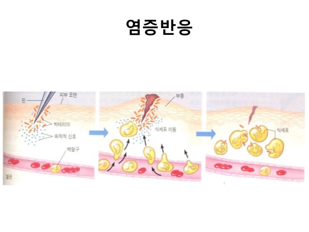  세포 손상과 염증 반응(면역 반응)