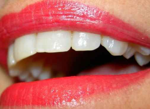 앞니 임플란트 시술을 잘하는 치과를 찾는 기준은...