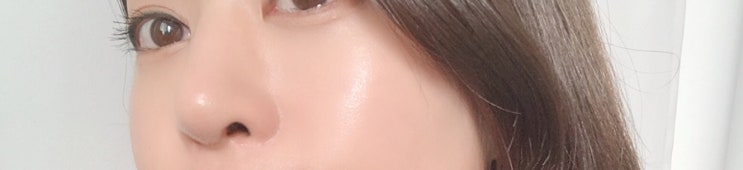  나이를 꺼꾸로 먹는 동안피부 리쥬란힐러 리프팅