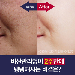  놀라운 개선효과 주름·기미·잡티 싹 없애는 '이것'