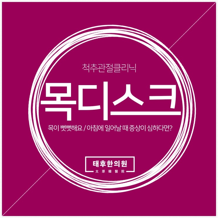  목이 뻣뻣해요 / 아침에 일어날 때 증상이 심하다면?