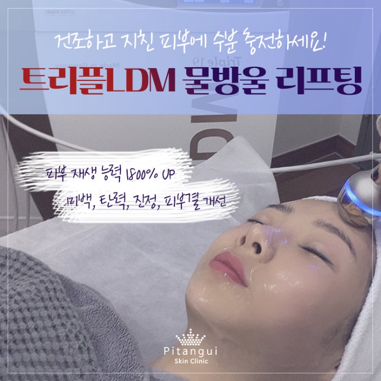  트리플LDM 물방울리프팅 리얼후기영상