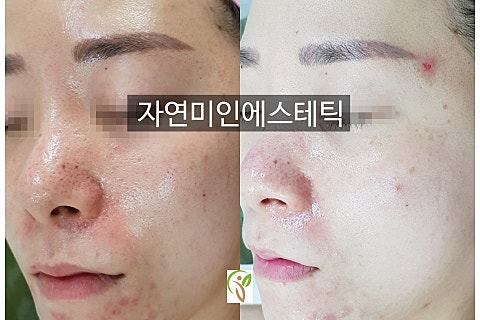 자연미인에스테틱 이미지