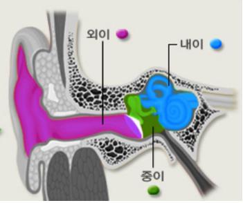  내이염 (미로염) 원인 증상 치료 상식