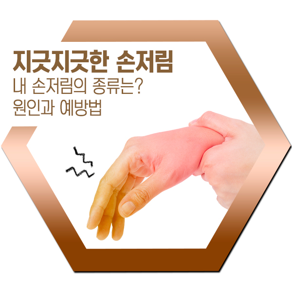  누구나 한 번쯤 겪는 손 저림 증상