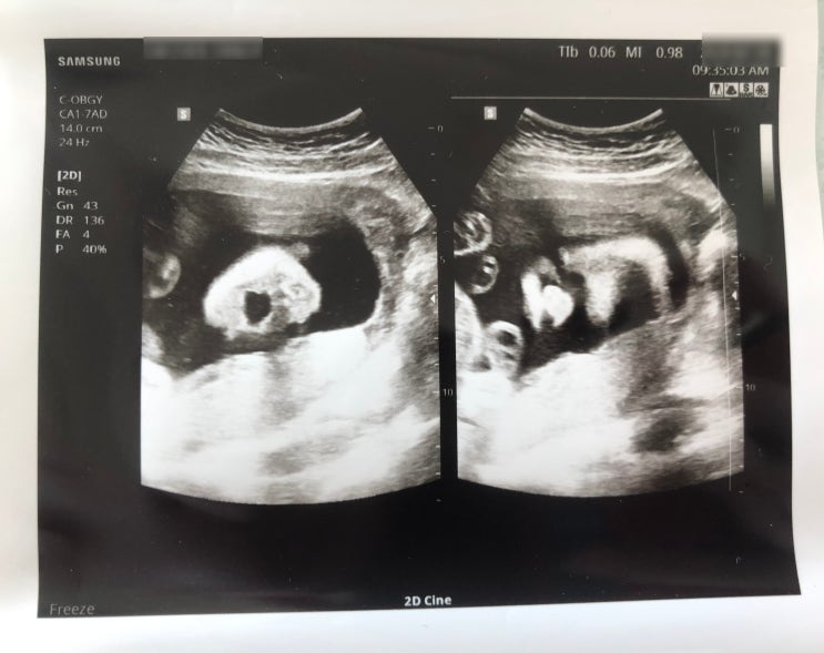  [임신일기] 임신주수별 아기크기 :: 산부인과 검진때마다 아기가 크다고 해서.. 찾아봤어요~