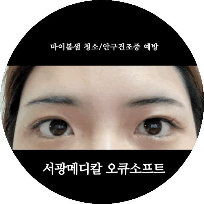 마이봄샘 눈꺼풀 청소 서광메디칼 안구건조증 예방 관리법