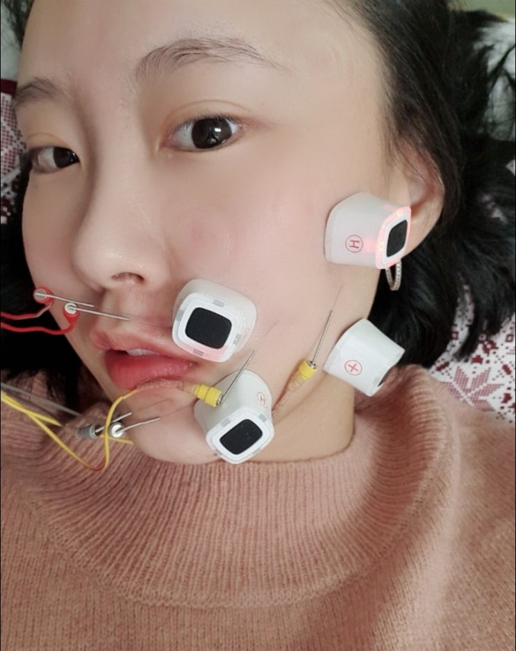  [추천]천안불당동 구안와사 / 비대칭치료 프렌차이즈한의원c