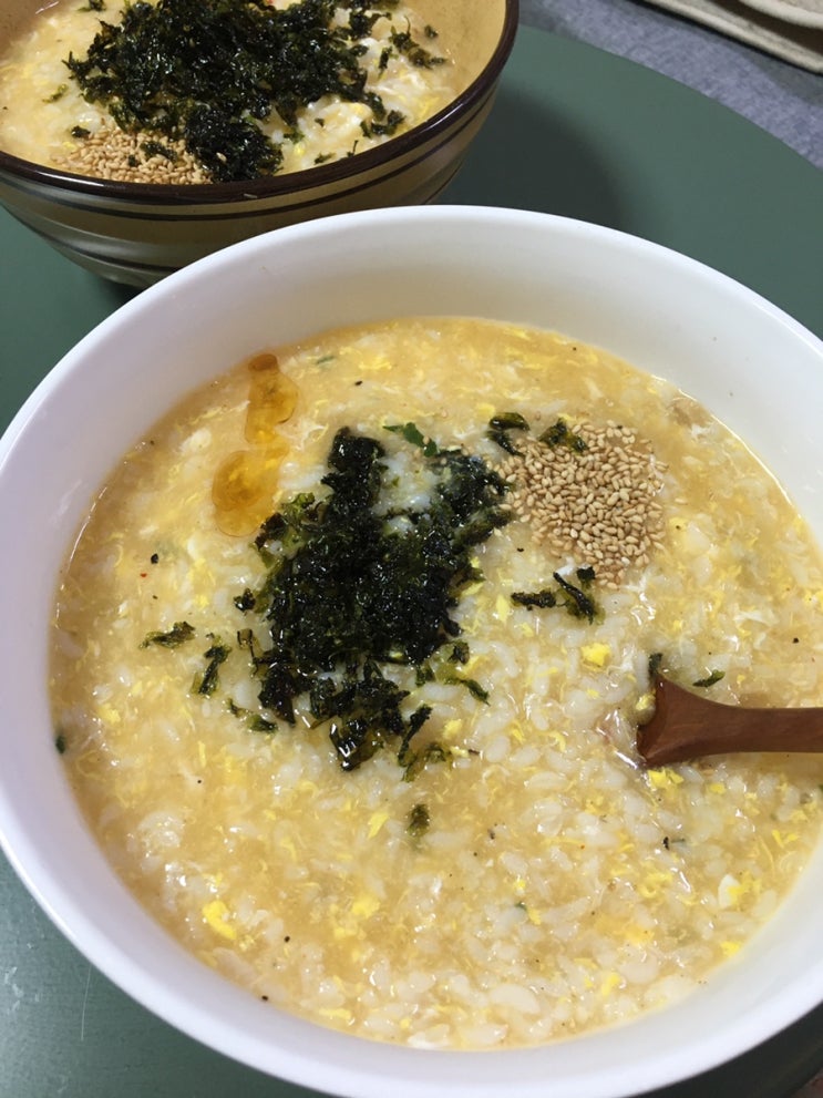  열심히 쏘다니다 사랑니 뽑힌 썰