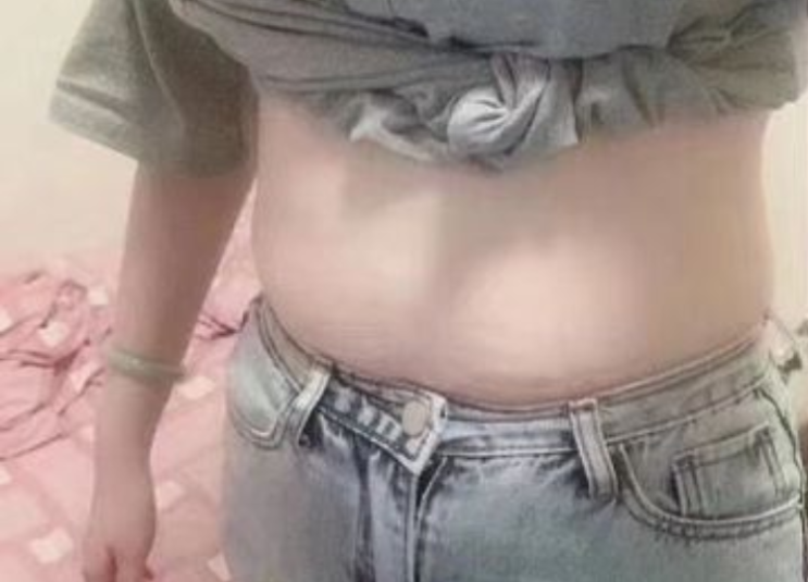  4주간 하체 다이어트 5KG감량 붓기스틱솔직후기요