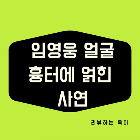  미스터트롯 진 임영웅 얼굴흉터/엄마/나이/콘서트