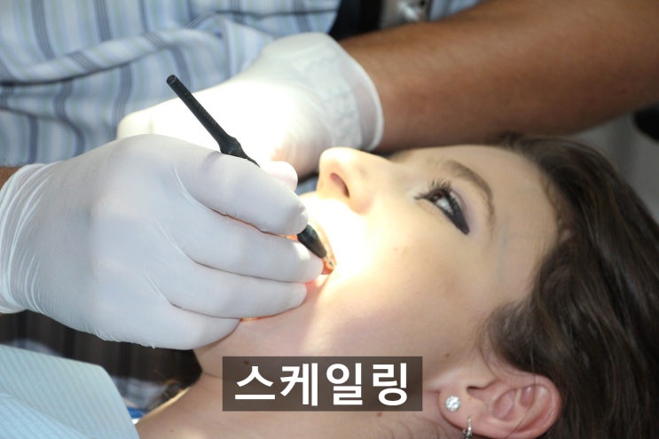 [건강] 치과에 보험적용 범위 / 보험치료