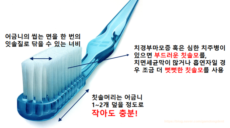  [당감동치과]칫솔의종류