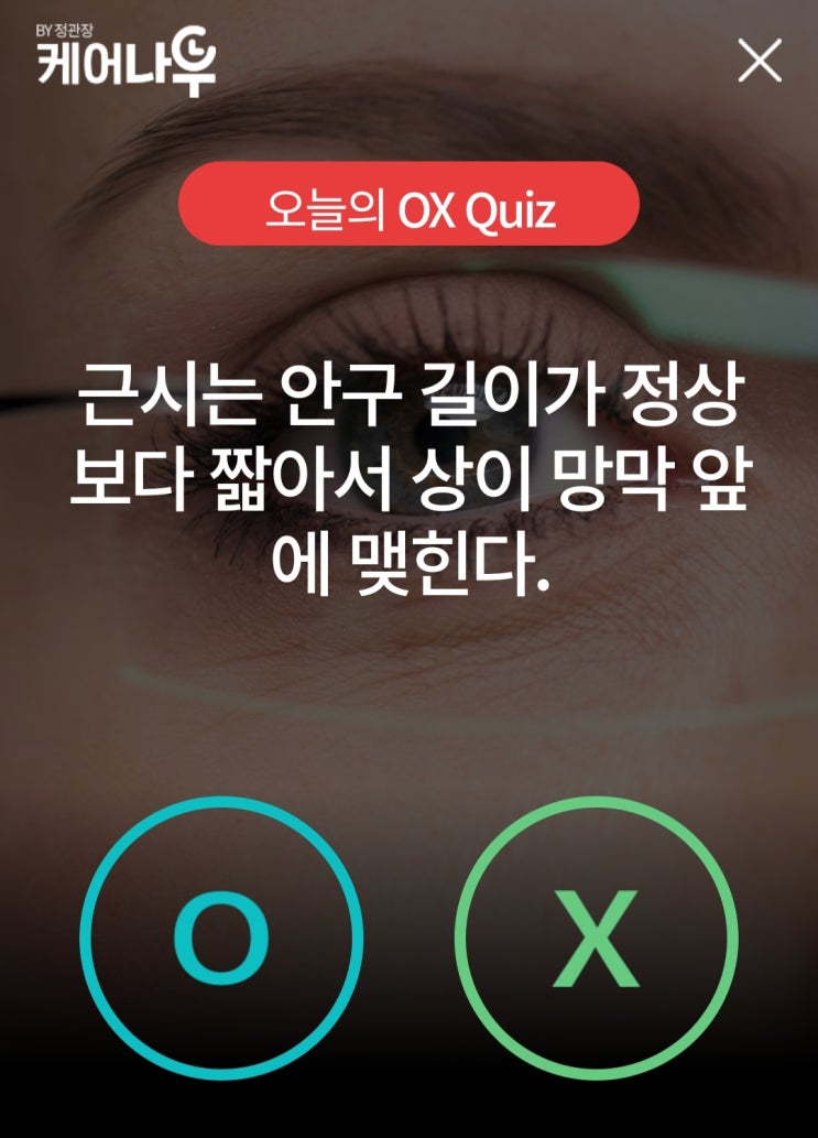  케어나우퀴즈 3월16일 근시의 안구 길이