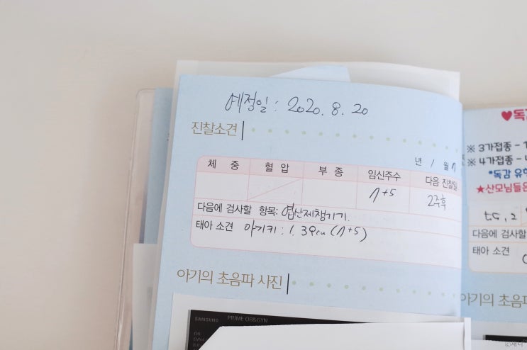  임신 극초기 증상 둘째 낳아보니 확실하네요