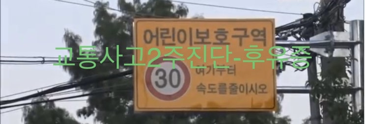  [보상상식]교통사고2주진단-후유증