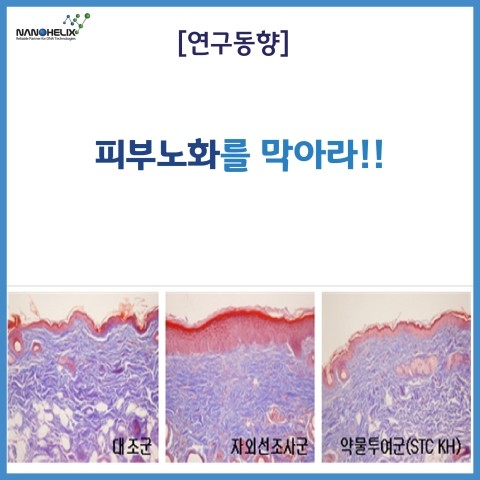  [연구동향] 피부노화를 막아라!!