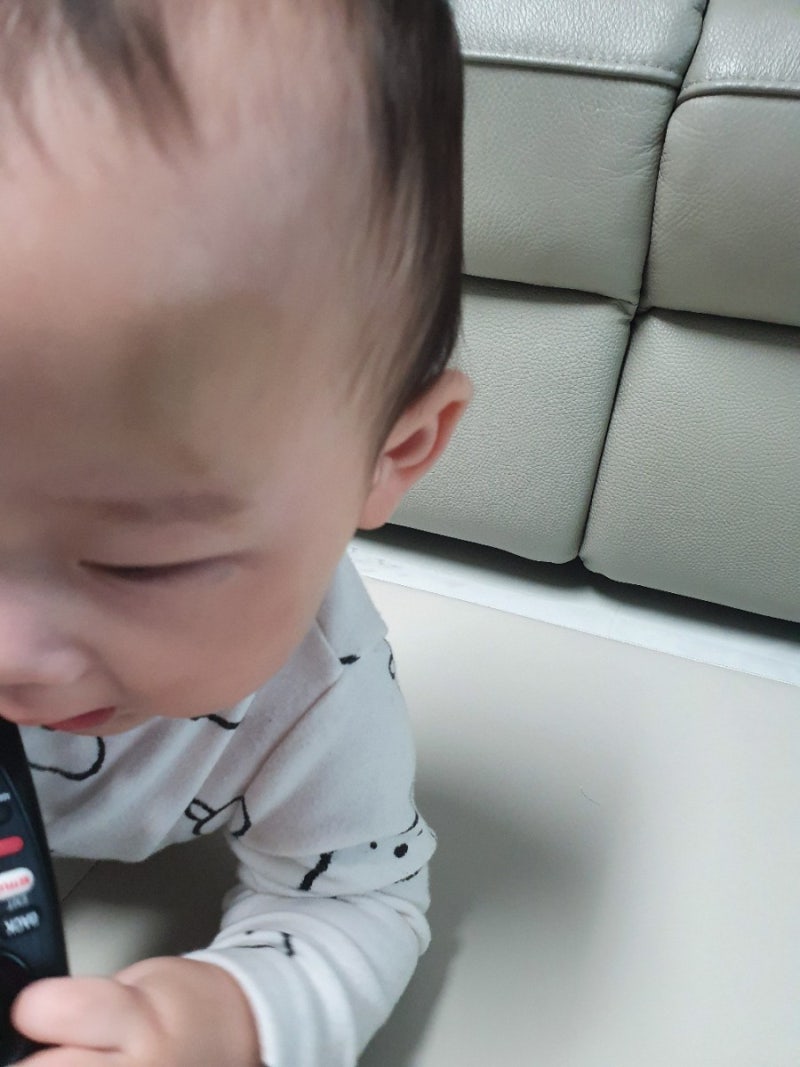 10개월 아기 넘어짐사고(멍크림후기) 6