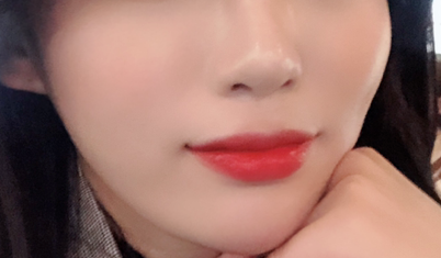  피부과 VVIP의 실리프팅 후기 (부작용, 통증)