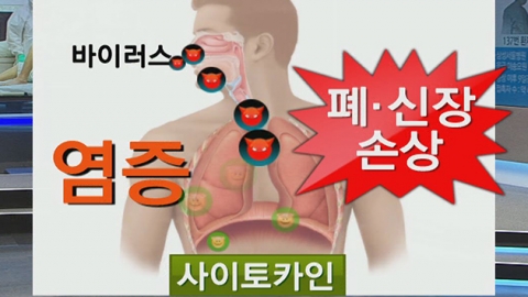 기저질환 없는 대구 17세 청소년 사망 원인은 사이토카인 폭풍? 코로나 사이토카인 폭풍이란? 뜻 의미