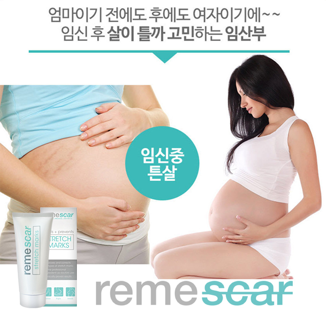 리메스카 스트레치마크 크림 100ml, 식약처인증 튼살크림 리메스카 100ml, 1개 추천해요 리메스카 스트레치마크 크림 100ml, 식약처인증 튼살크림 리메스카 100ml, 1개 추천해요
