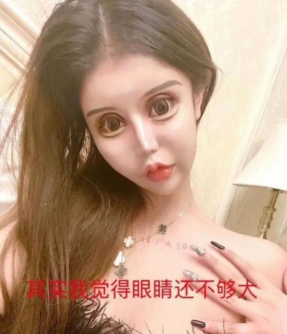 [중국이슈] 중국 17세 성형중독 소녀, 60번의 성형 수술